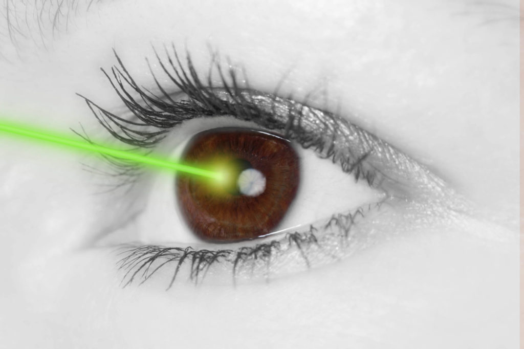 opération laser des yeux à Bruxelles