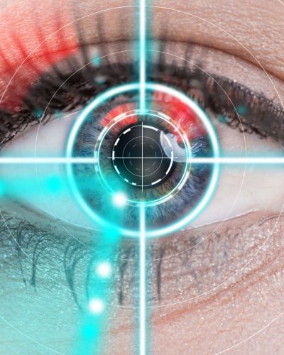 Opération de yeux au laser à Bruxelles