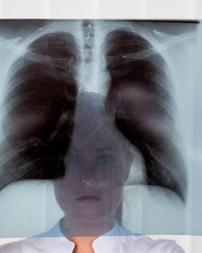 Radiographie à Bruxelles